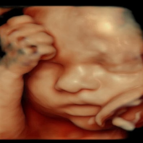 Picture5